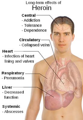 heroin effects